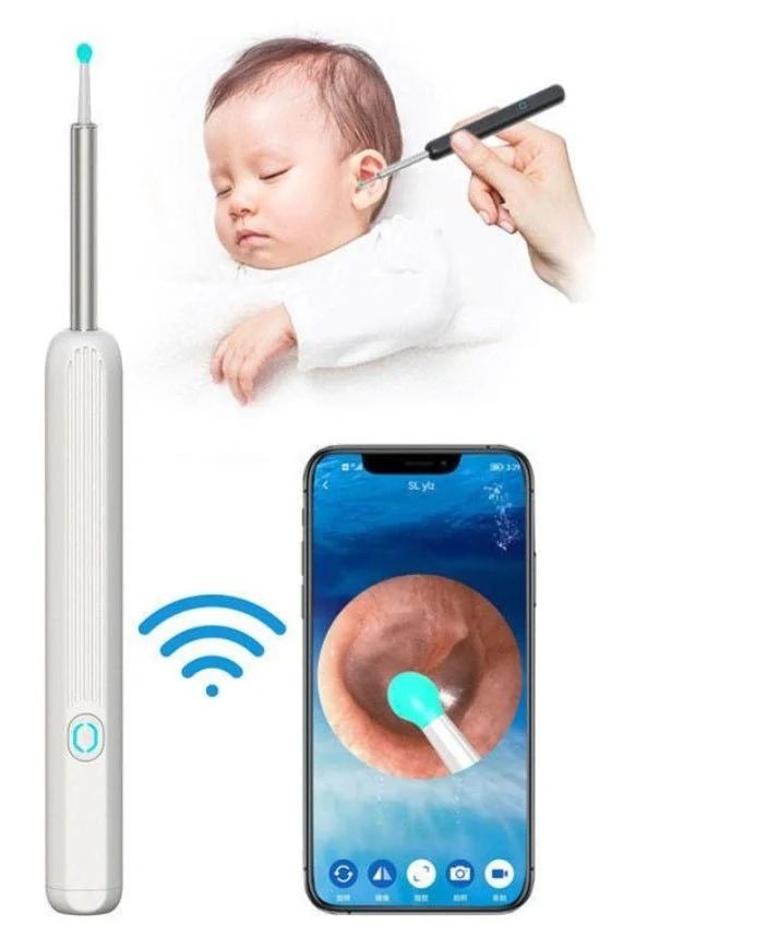 HD Wireless Visual Ear Cleaner Camera | Type-C & iOS/Android Compatible Earwax Removal Kit G. arbia.