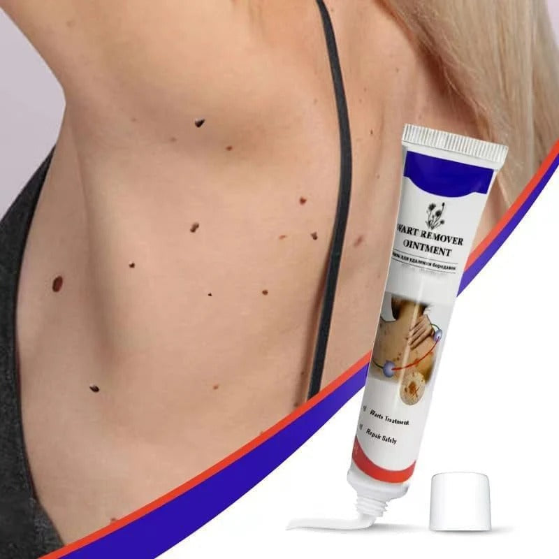 Fast & Effective Warts Remover | Natural Skin Care Formula