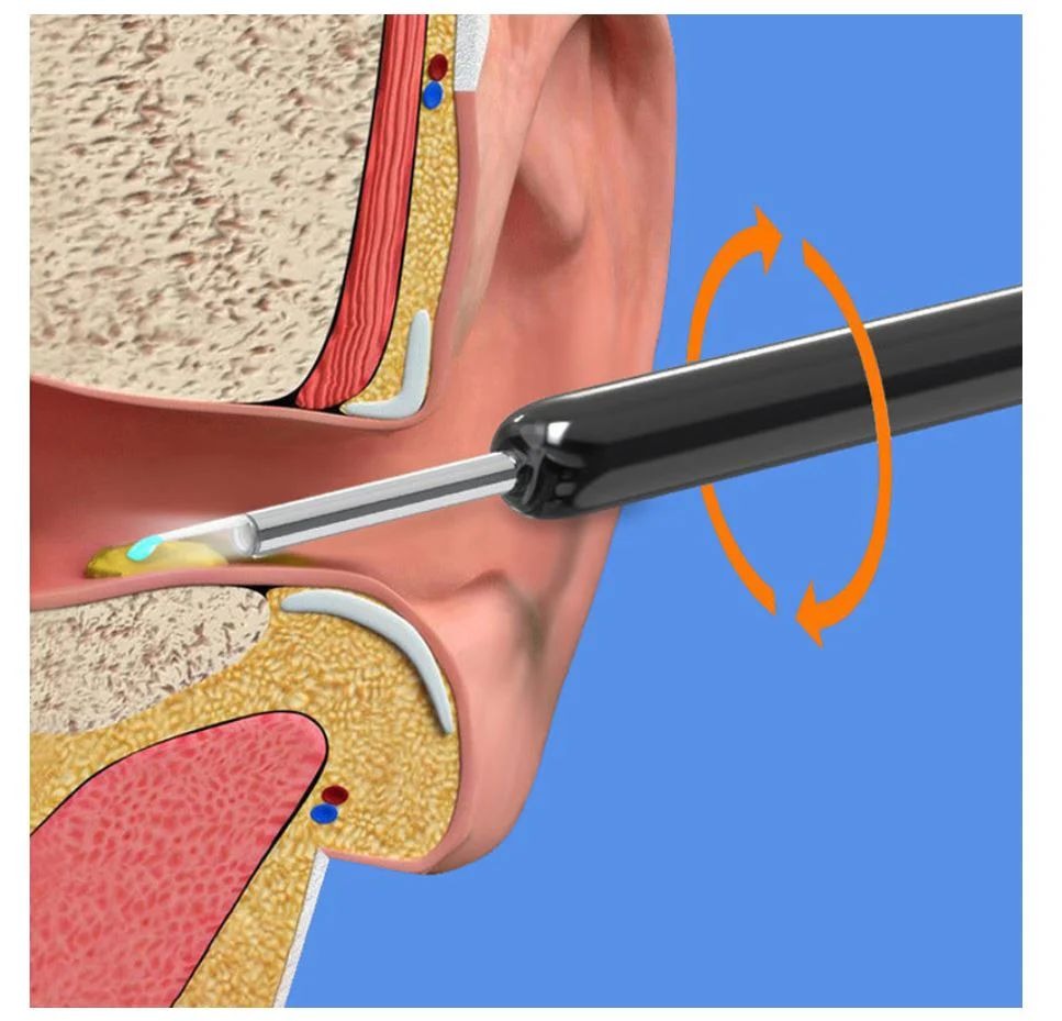 HD Wireless Visual Ear Cleaner Camera | Type-C & iOS/Android Compatible Earwax Removal Kit G. arbia.