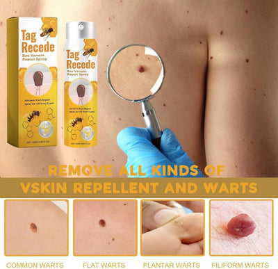 Tag recede Bees Treatment Spray Review by Reem Al Falasi